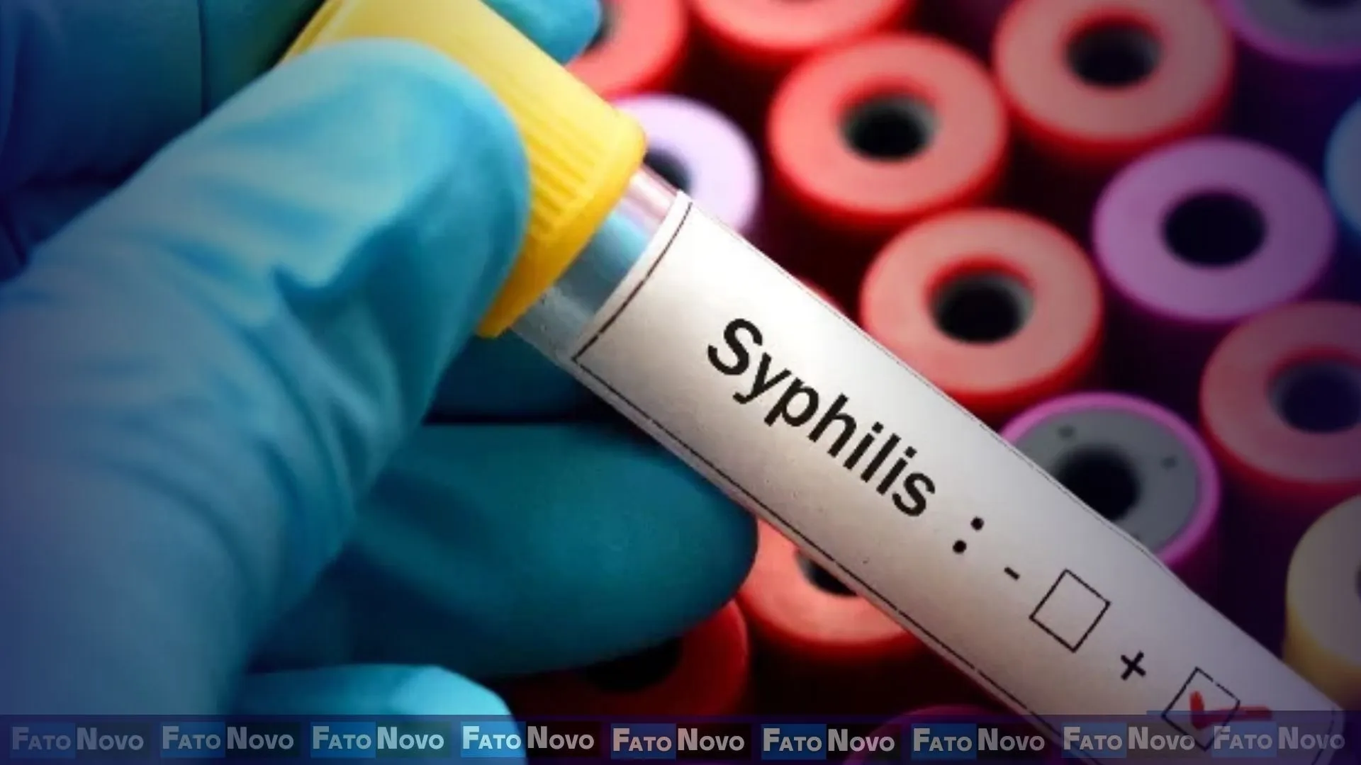 Diagnóstico Precoce é fundamental no combate à Sífilis e Sífilis Congênita, alerta especialista